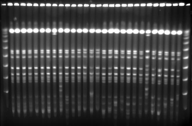 Klebsiella pneumoniae produkująca karbapenemazy typu New Delhi Sytuacja