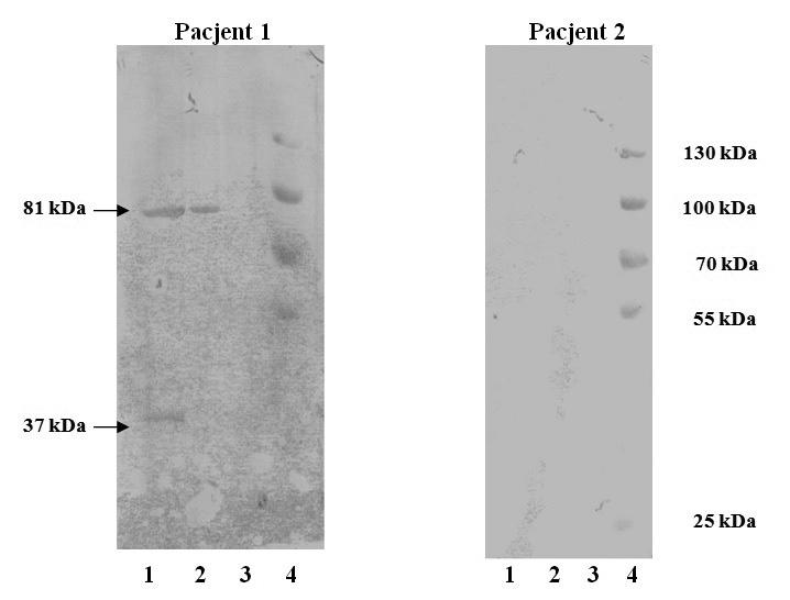 252 N. Rokosz-Chudziak i inni Nr 4 Ryc. 5. Wynik reakcji w odczynie western-immunoblotting białek Y. enterocolitica 1B/O8 z surowicami pacjentów z jersiniozą. Ścieżki: 1 - szczep Y.