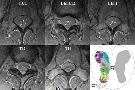 Sekwencje zaawansowane fmri rdzenia kręgowego- stan prawidłowy