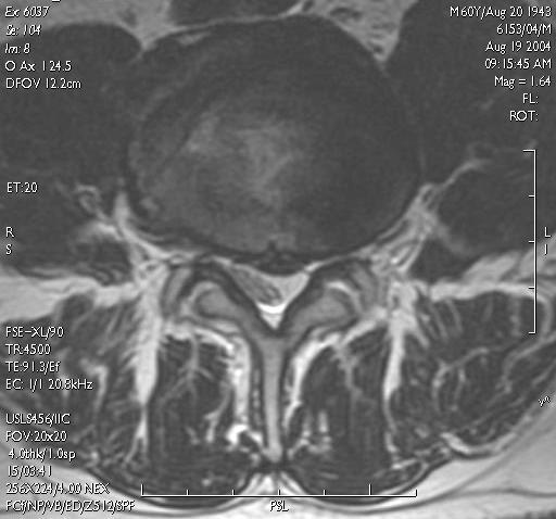 (cleft) szczelina (cleft) szczelina (cleft)