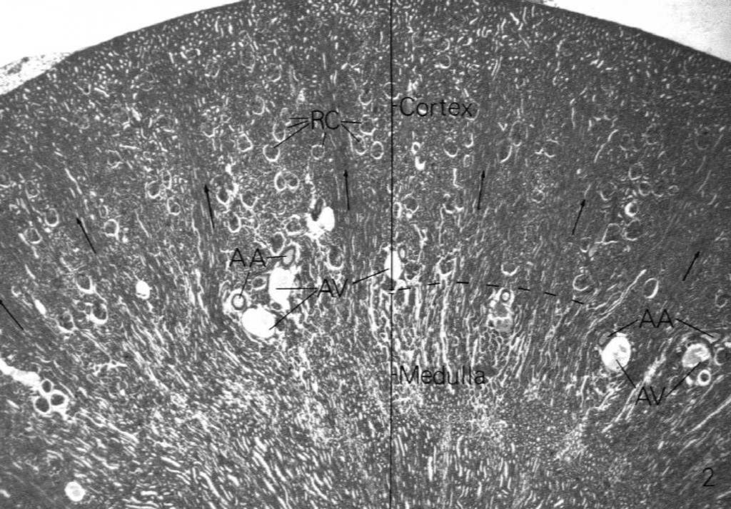 Kanaliki nerkowe nefrony (nierozgałęzione, mają kolejne odcinki różniące się budową histologiczną i funkcją) cewki