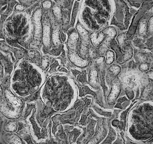 komórki ziarniste komórki mezangium podocyt przestrzeń t. Bowmana komórki mezangium plamka gęsta tętniczka wyprow.