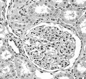 reninaangiotensyna-aldosteron Angiotensyna I konwertaza (ACE)