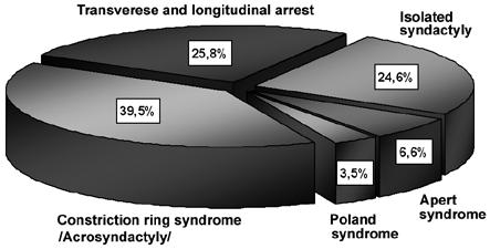 Protocol of Treatment of Syndactyly 73 Fig. 1. Distribution of the analyzed population according to disease location Ryc. 1. Rozkład badanej populacji względem umiejscowienia choroby Fig. 2.