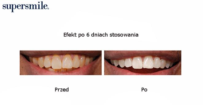 ODŚWIEŻA: Wodorowęglan sodu jest bakteriobójczy i zapewnia świeży oddech. WZMACNIA: Kombinacja wapnia, fosforanów i magnezu remineralizuje szkliwo. CHRONI: Zwalcza próchnicę za pomocą fluoru (0.