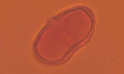 Wykorzystanie androgenezy w kulturach pylnikowych do otrzymywania homozygotycznych roœlin marchwi datkiem wêgla brunatnego, supersorbentu Alcosorb 400, szczepionki Glomus oraz kredy i
