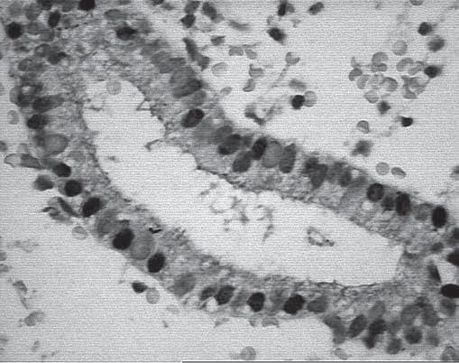 histologicznego 