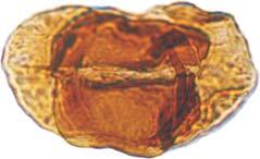 Ryc. 3. Miospory pogranicza permu i triasu z otworu Tumlin Podgrodzie IG 1.