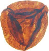 Lundbladispora obsoleta Protohaploxypinus pantii: I Lundbladispora obsoleta