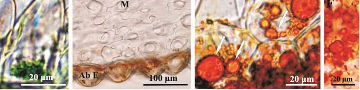 visible in the basal part of the protoplast; C cross section of the spurred petal with the conical papillae in the adaxial epidermis (AdE), mesophyll (M) with large intercellular spaces and the