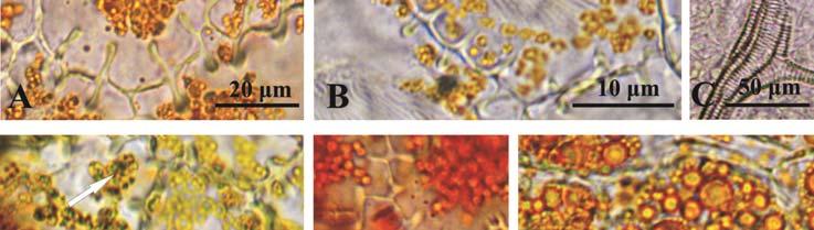 Branched vascular bundles in the petal mesophyll; D epidermis cells with numerous chloroplasts and dark starch grains after the IKI treatment (arrows); E red coloured lipid droplets and chromoplasts