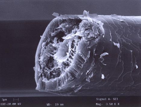 Cuticle and cross-section of