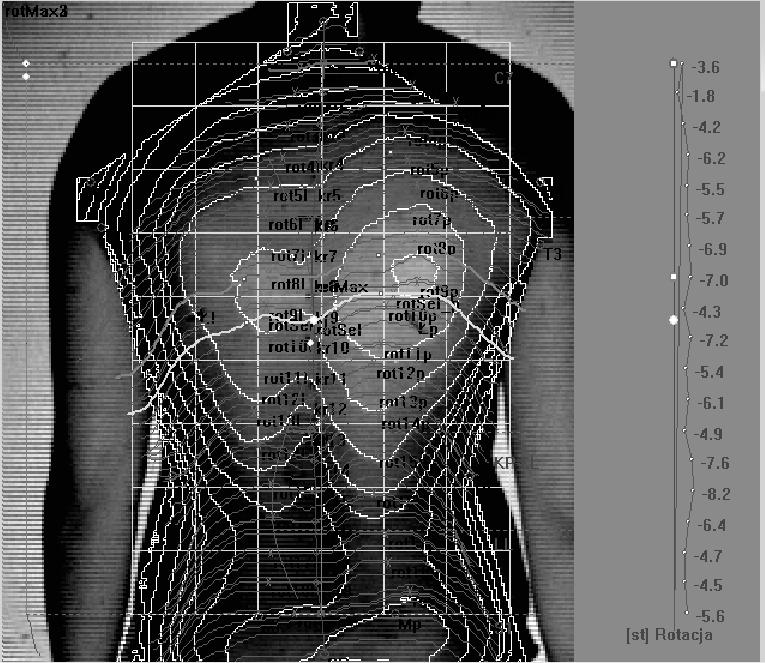Postępy Rehabilitacji (4), 41 46, 2013 43 Program automatycznie przelicza poszczególne parametry [5,6,7,8] (Ryc.2).