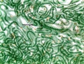 Procaryota