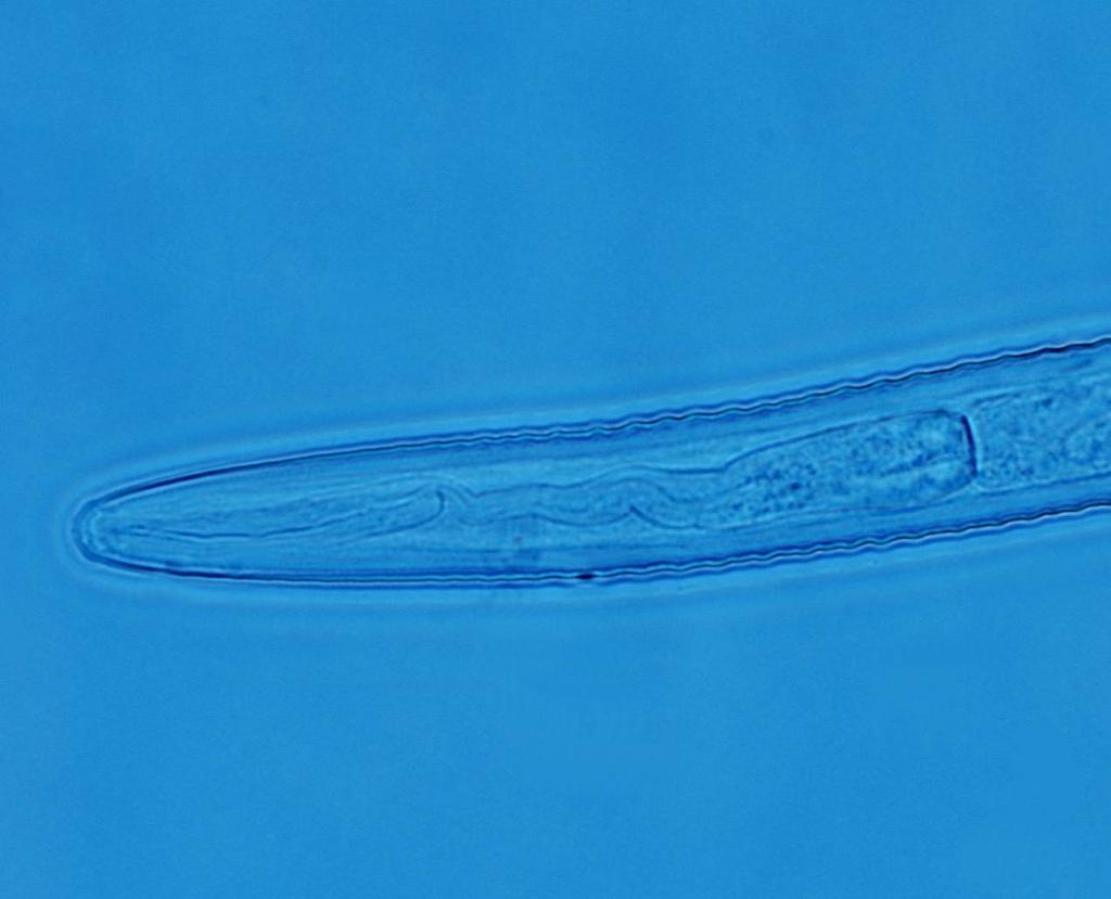 Krępaki (Trichodorus sp., Paratrichodorus sp.
