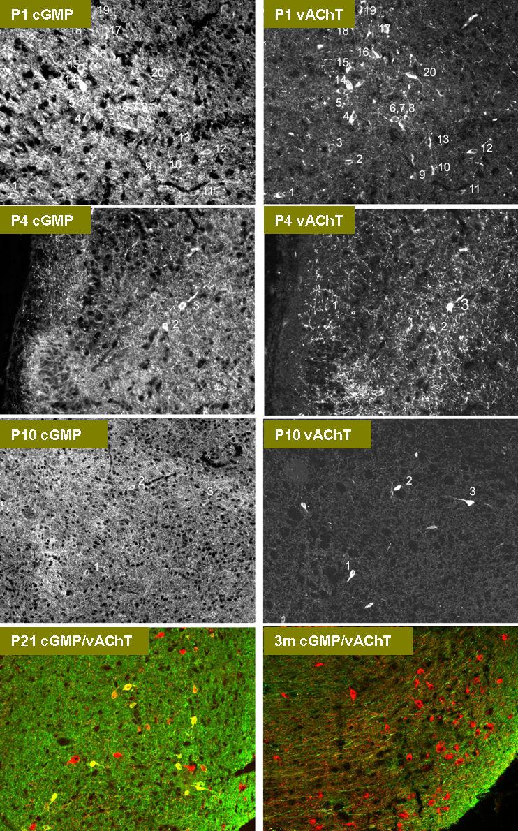 Rycina 12. Lokalizacja cgmp (zielony) i vacht (czerwony) w serii skrawków mózgu metodą immunohistochemiczną (kolokalizacja widoczna w komórkach i włóknach jako kolor żółty).