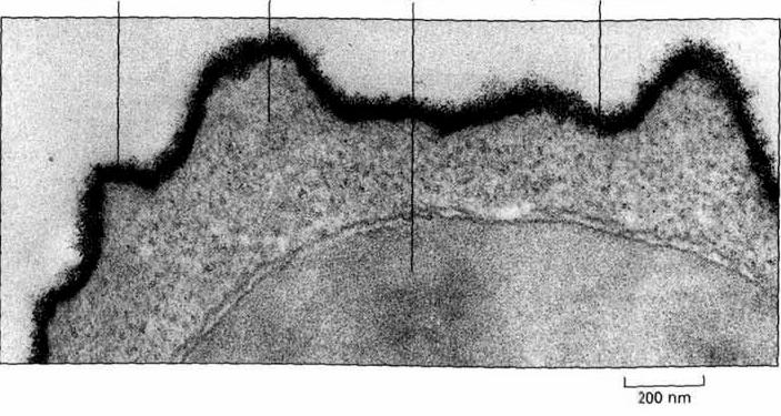 cytoplazma jądro błona komórkowa Mikrografia