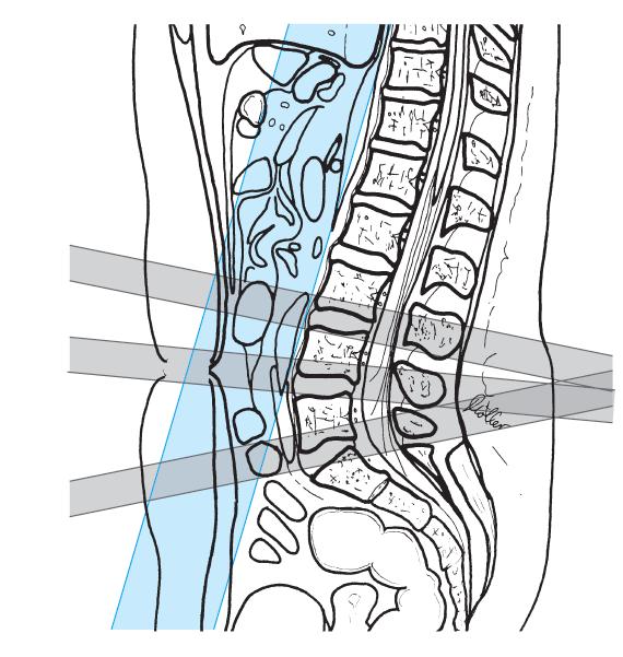 płaszczyzna poprzeczna= axiale MRI parameters