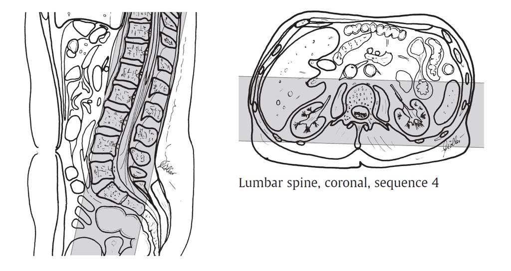 płaszczyzna koronalna= coronalna MRI parameters