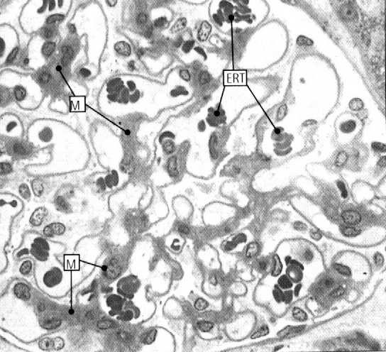 filtracyjną ciałka nerkowego komórka
