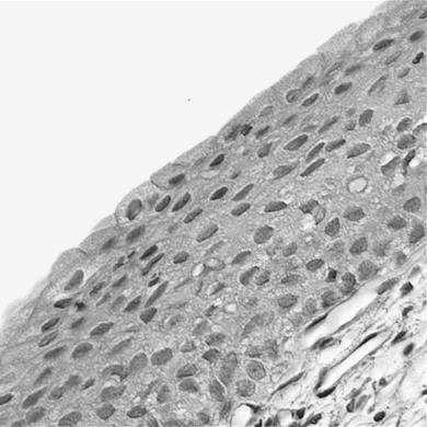 śródmiąższowe rdzenia: specyficzny rodzaj miofibroblastów wydłużone, zawierają krople lipidowe