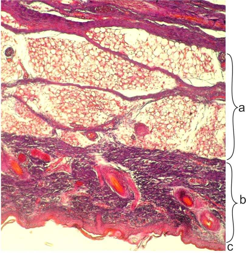 Warstwy skóry: a) tkanka podskórna zraziki tkanki tłuszczowej otoczonej tkanką