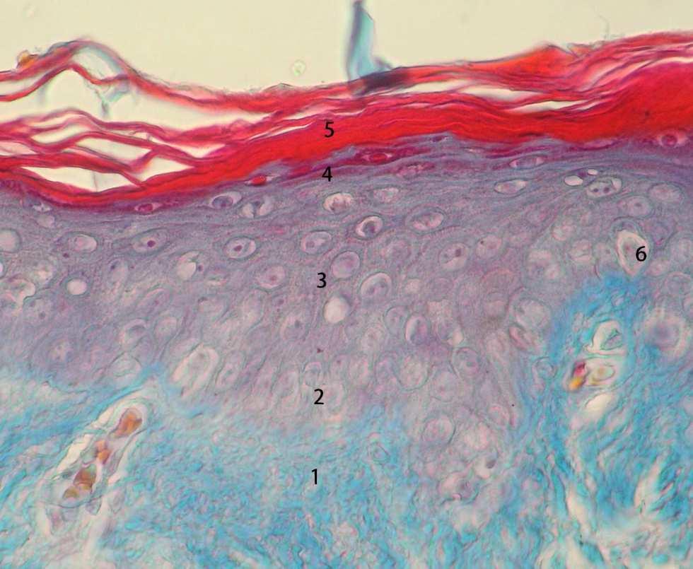 4) warstwa o wyraźnie spłaszczonych, wrzecionowatych komórkach wypełniających się czerwonymi ziarnistościami to warstwa ziarnista; 5) czerwona warstwa zrogowaciała, widać złuszczające się warstwy