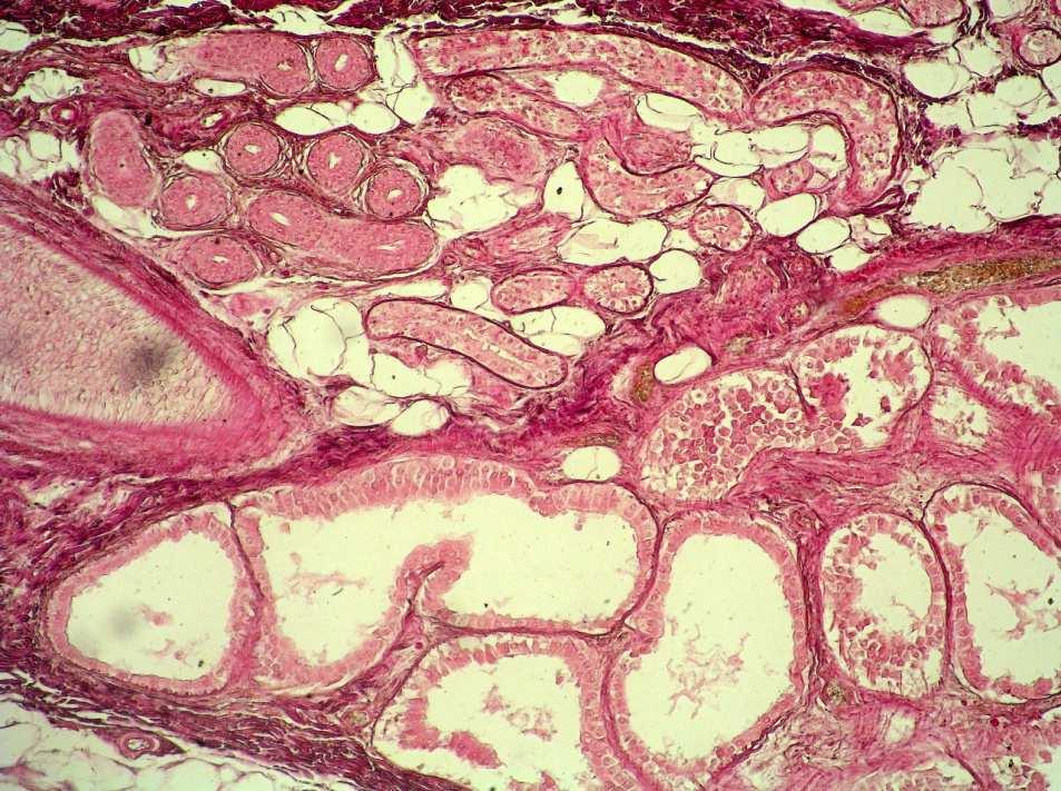 są komórkami mioepitelialnymi (2). 3 część wyprowadzająca gruczołu, węższa i bez komórek mioepitelialnych. 4 tkanka tłuszczowa Ryc. 39.