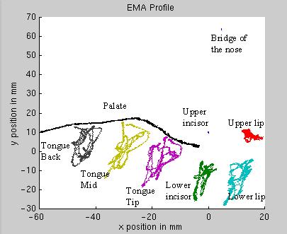 artykulografem (EMA) P.
