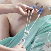 EKG dla wszystkich 16 odprowadzeń do późniejszego przeglądania i wykorzystania