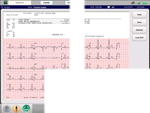 TraceMasterVue System TraceMasterVue Rozszerza możliwości elektrokardiografu PageWriter dzięki najnowszej dwukierunkowej komunikacji bezprzewodowej, co pozwala z łatwością przyspieszyć wymianę danych