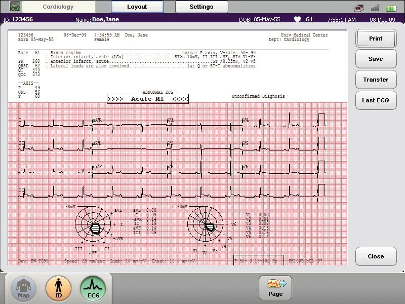 Zaawansowane wspomaganie decyzji w diagnostyce STEMI Optymalizacja decyzji klinicznych dzięki zaawansowanym funkcjom zgodnym z najnowszymi zaleceniami medycyny klinicznej.