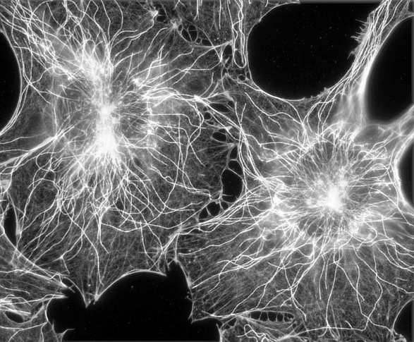 Cytoszkielet Mikrotubule tubulina protofilament rureczki zbudowane z tubuliny - +