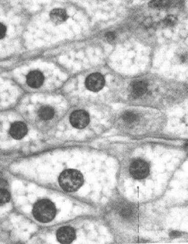 Materiały zapasowe i wtręty cytoplazmatyczne nekroza apoptoza Śmierć komórki: