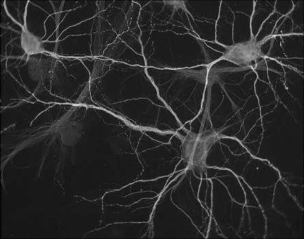 Komórki: komórki nerwowe (neurony) - sygnalizacja, neurosekrecja komórki neurogleju (glejowe) - ochrona, wspomaganie Tkanka
