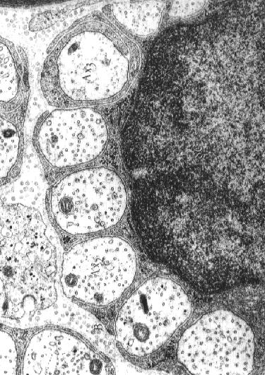 zagłębieniach błony komórkowej komórek Schwanna W zależności od typu osłonki, włókna nerwowe mogą być: zmielinizowane (y