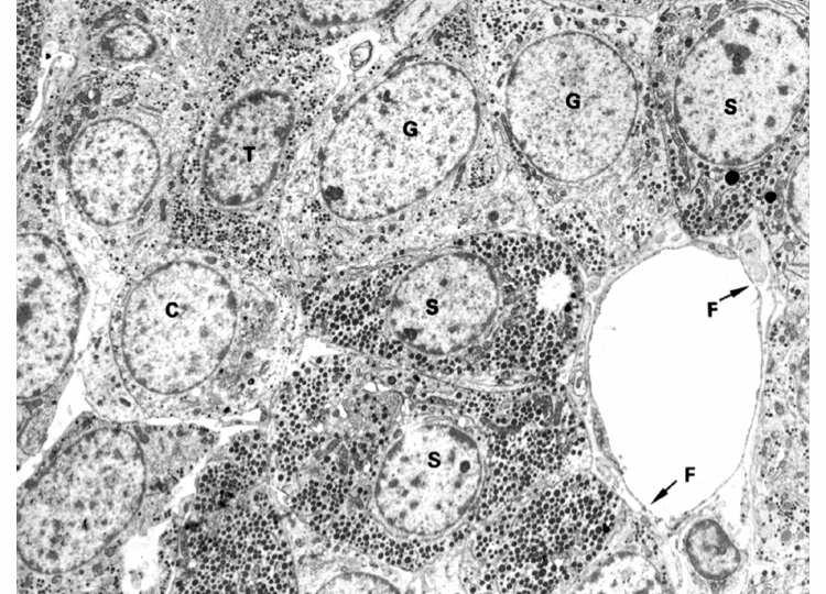 BARWNIKOCHŁONNE (liczne ziarna) KWASOCHŁONNE - SOMATOTROPY - MAMMOTROPY ZASADOCHŁONNE Charakterystyka komórek barwnikochłonnych Kwasochłonne: obfita szorstka siateczka, ap.