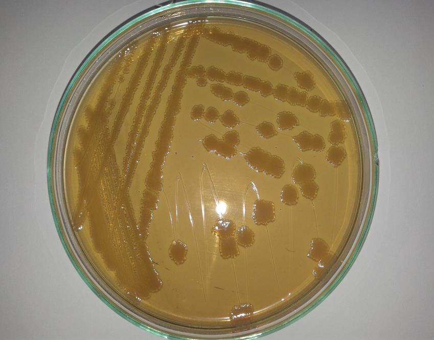 wzrost Escherichia coli na