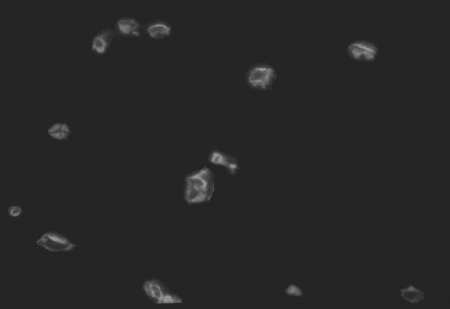Laminopati¹ okaza³a siê równie ograniczona dermatopatia (restricted dermatopathy).
