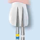 6 Instrumenty do usuwania amalgamatu Amalgam remover Finiry Q Q-Finishers 500 314 