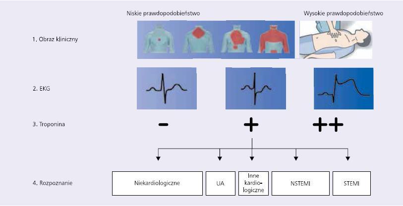 Tabela 1. Wstępna ocena pacjenta z podejrzeniem ostrych zespołów wieńcowych.