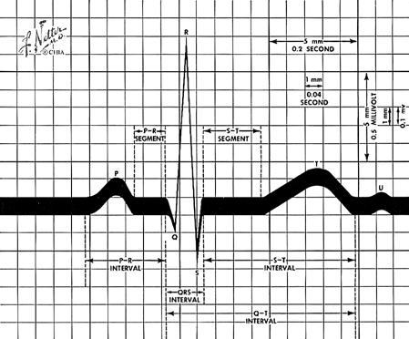 Rycina 2. Prawidłowy obraz zapisu ekg z zaznaczony-mi pomiarami odstępów (ang. intervals) wg Nettera Zaburzenia przewodzenia p-k mogą być trojakiego rodzaju.