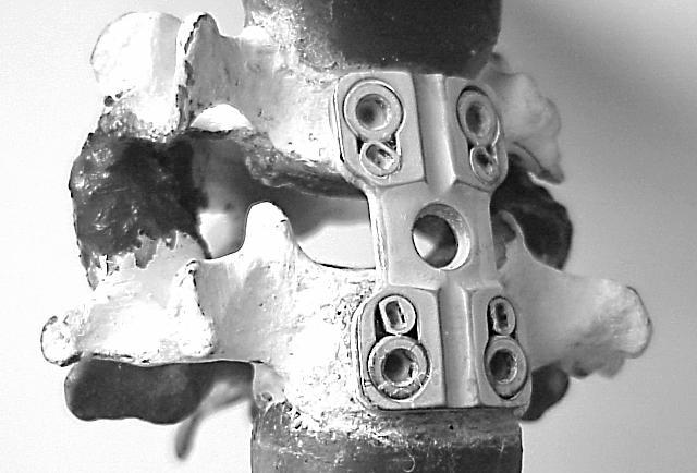 C5 Połączenie stawowe Stabilizator C6 a) Rys. 9.