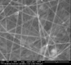 nanokompozytowe CA/Fe 3 O 4 :CA/HAp Biomimetryczn architektura macierzy zewnątrzkomórkowej wzbogaconej o nanocząstki stymulujące komórki
