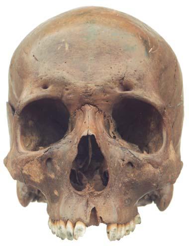 Fig. 2. Human skull from the wreck of General Carleton. Il.