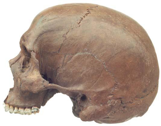 Skull in norma frontalis. Il. 3. Czaszka w norma frontalis.