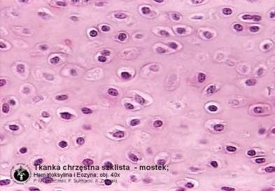 4. Tkanka łączna. Tkanka łączna zbudowana jest z luźno ułożonych komórek, pomiędzy którymi znajduje się substancja międzykomórkowa.