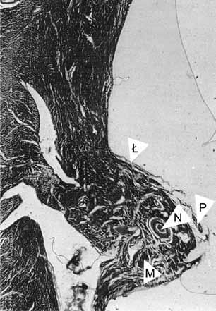 brodawkowatych przednich obserwowano zmienną liczbę tętnic o podobnym przekroju, w których świetle występowały elementy morfotyczne krwi (rycina 4). Rycina 2.