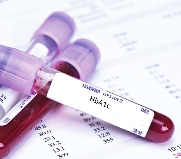 krwi przetoczenia krwi ciąży Ocena HbA1c jest doskonałym parametrem pozwalającym na stwierdzenie skuteczności terapii cukrzycy.