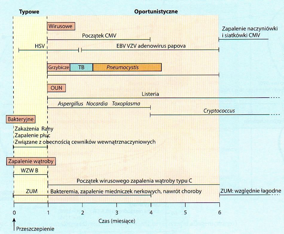 Występowanie zakażeń u biorców przeszczepów nerek w zależności od okresu po przeszczepieniu ZUM- zakażenia układu moczowego HSV (Herpes Simple virus)- wirus opryszczki